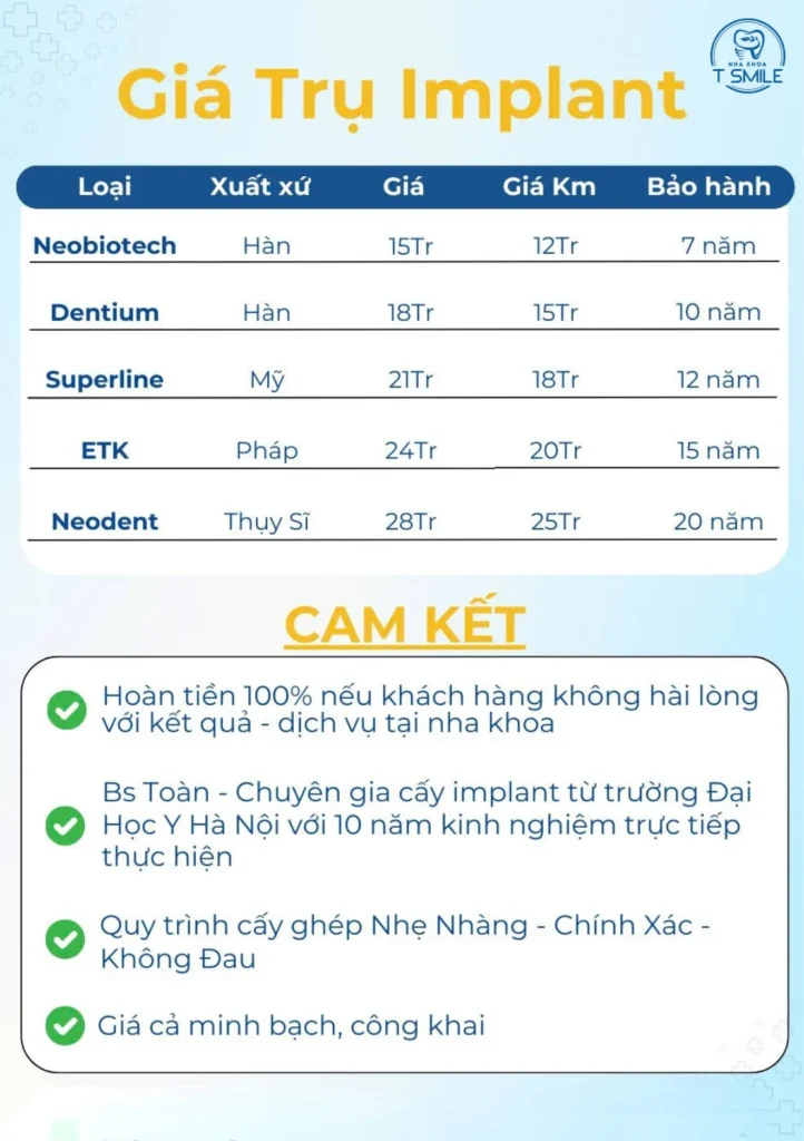 bảng giá trồng răng implant