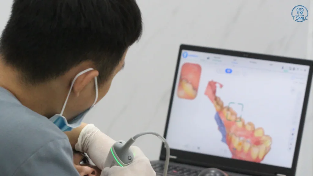 trồng răng sứ mất bao lâu
