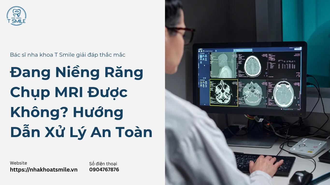 niềng răng chụp MRI được không