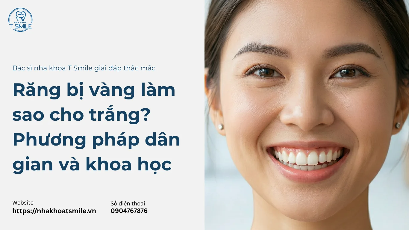 răng bị vàng làm sao cho trắng