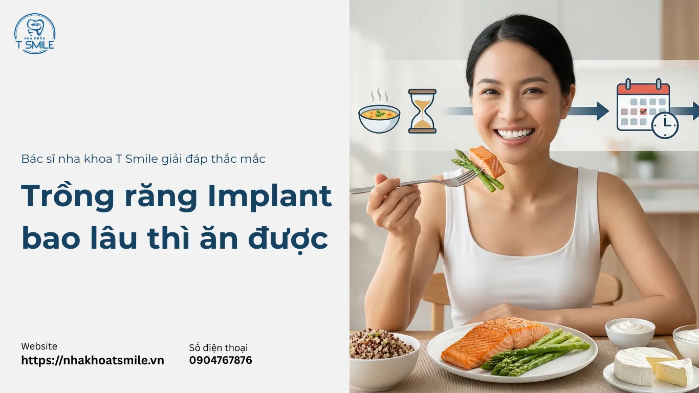 trồng răng implant bao lâu thì ăn được