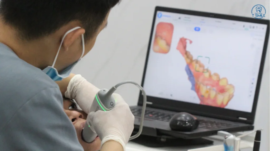 răng trám có niềng được không
