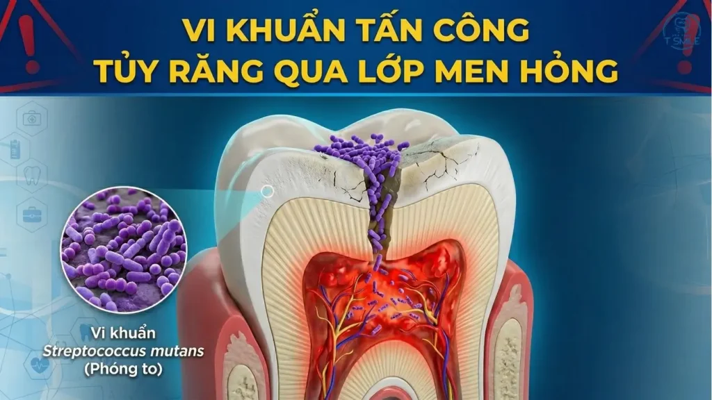 hậu quả bọc răng sứ giá rẻ