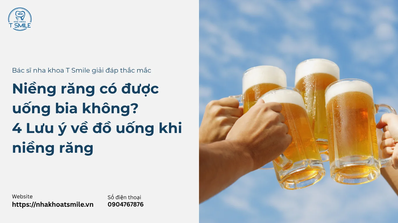 niềng răng có uống bia được không