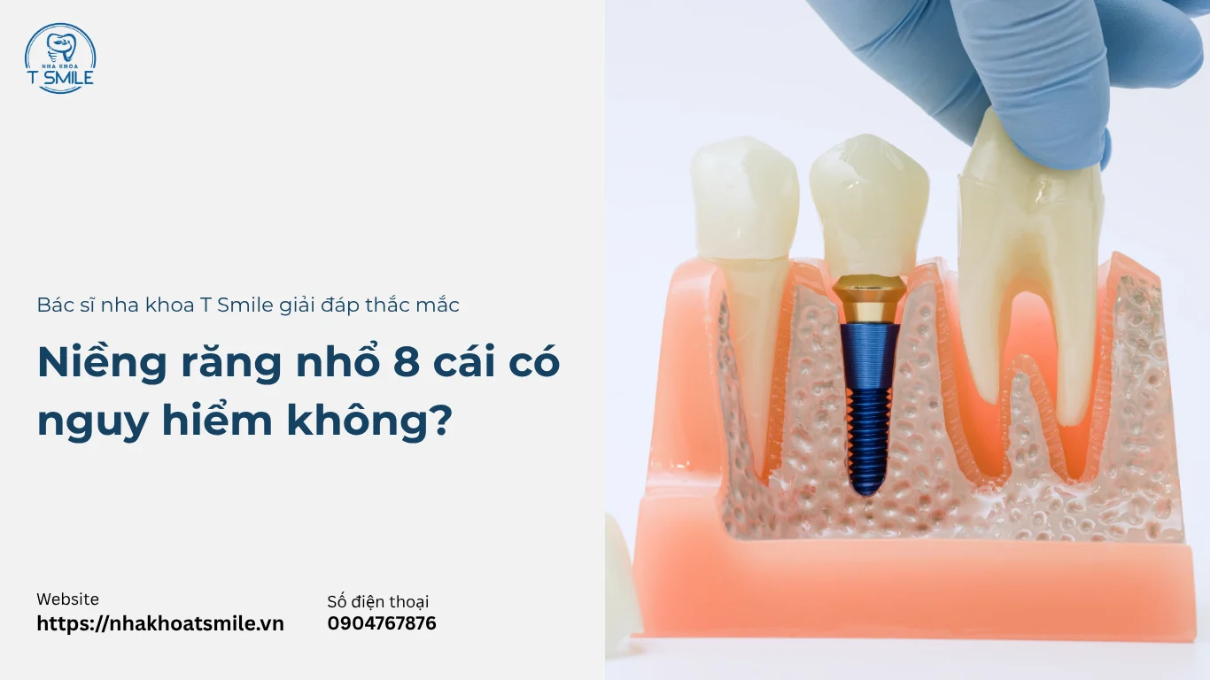 niềng răng nhổ 8 cái
