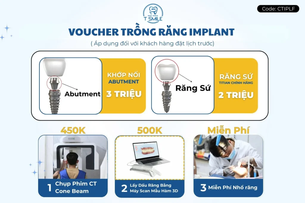 voucher trồng răng implant
