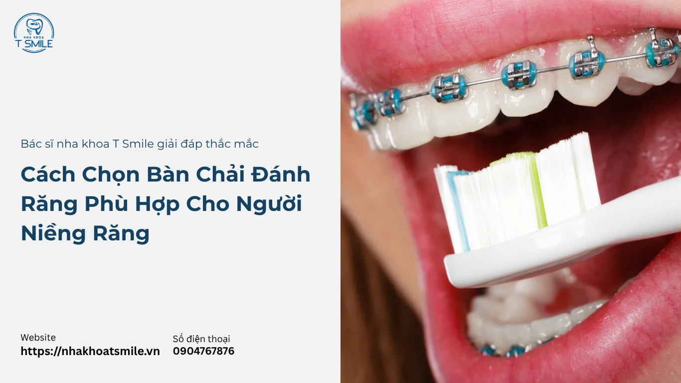 bàn chải đánh răng cho người niềng răng