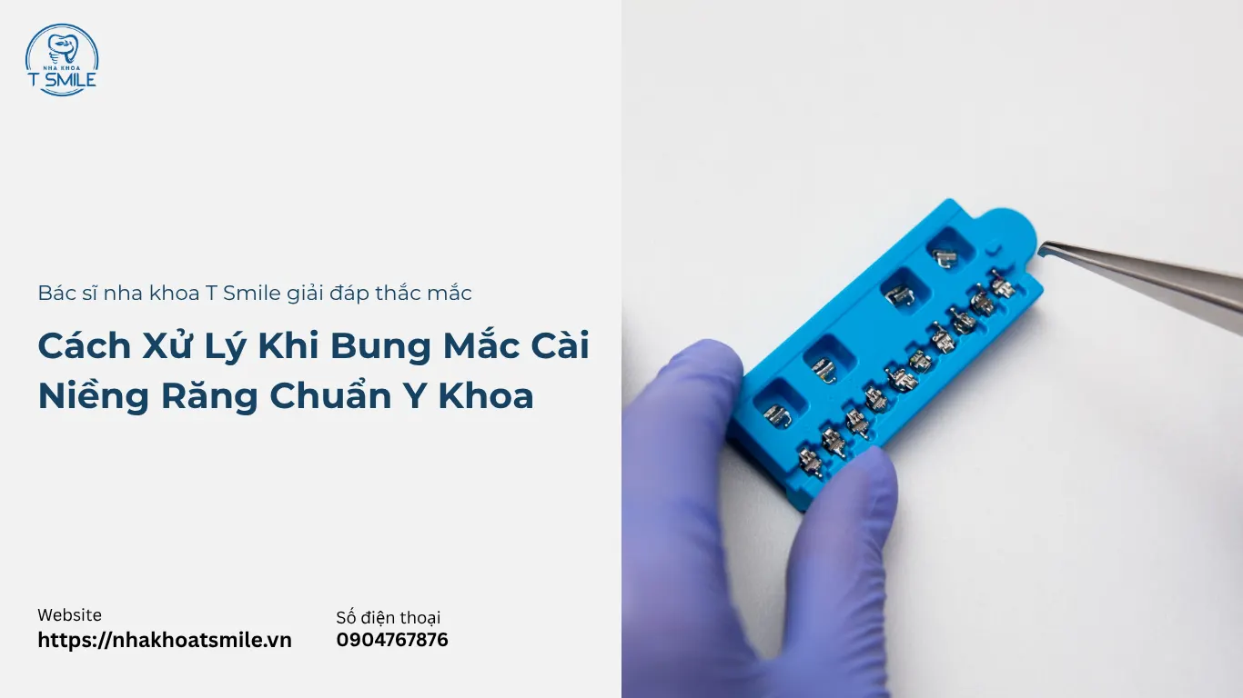 bung mắc cài niềng răng