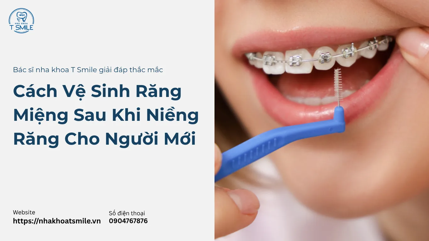 Cách vệ sinh răng miệng sau khi niềng răng