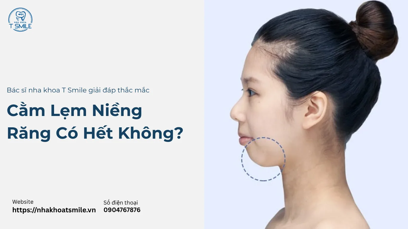 cằm lẹm niềng răng