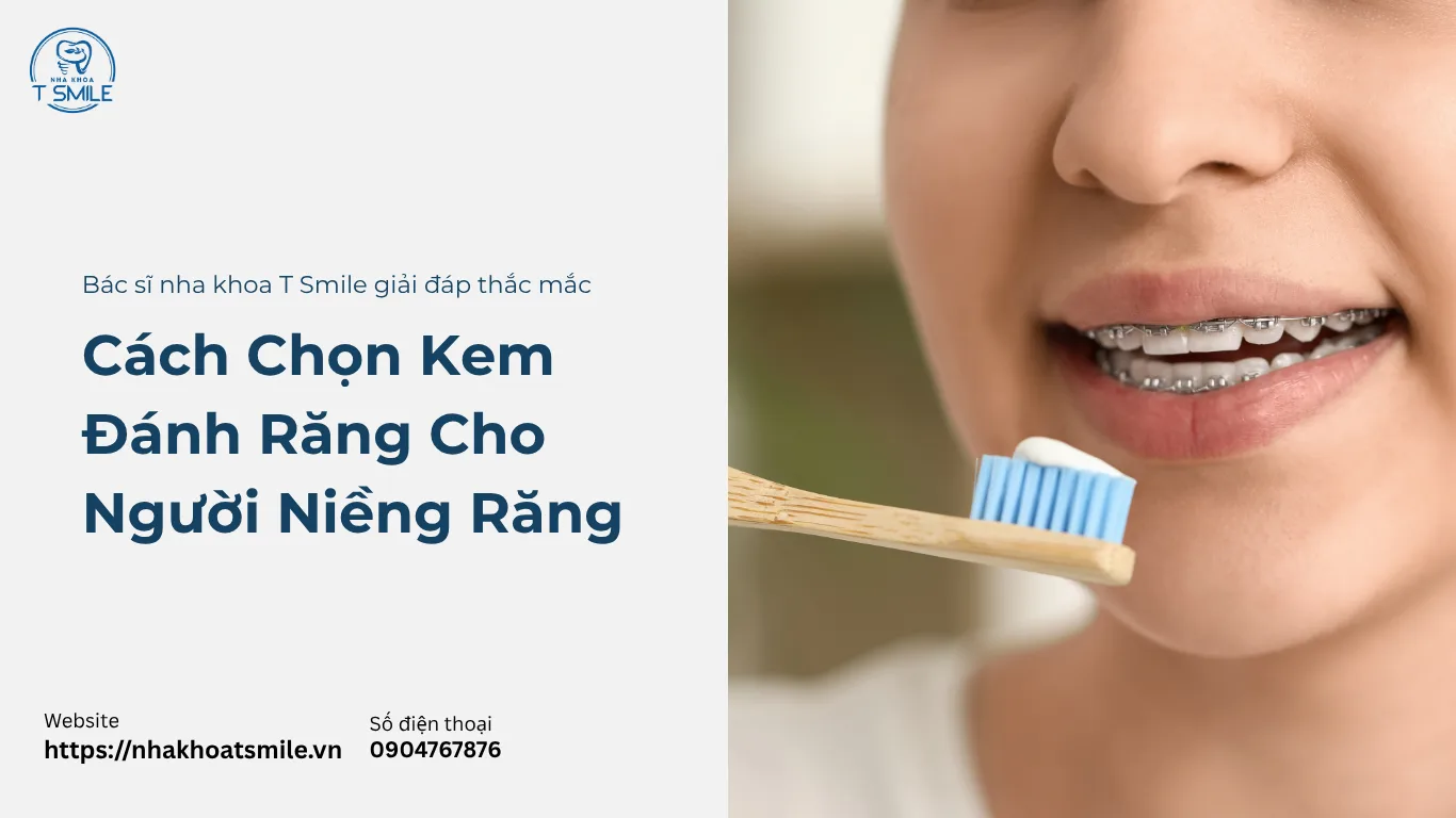 cách chọn kem đánh răng cho người niềng răng
