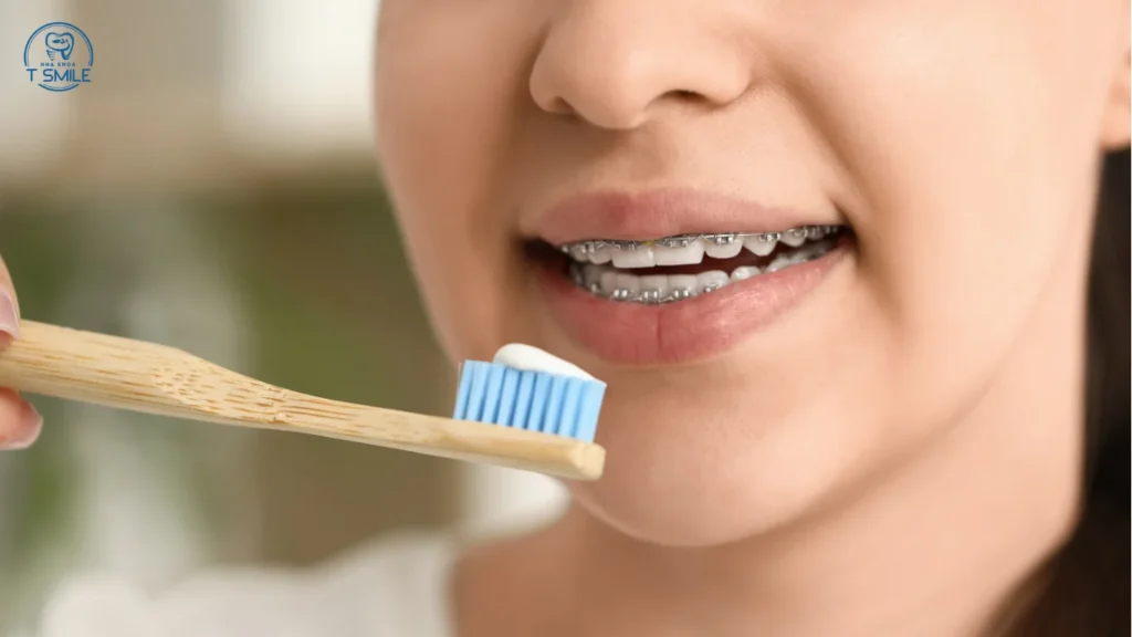 viêm nướu răng có tự hết không