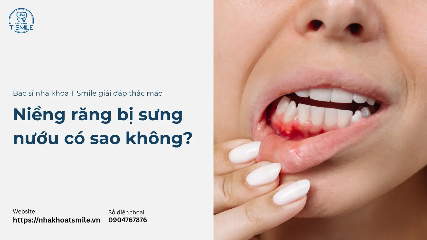 niềng răng bị sưng nướu