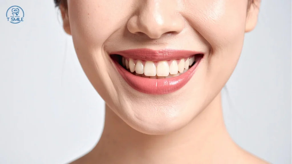 có nên tẩy trắng răng trước khi niềng răng