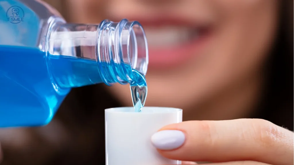 nước súc miệng cho người niềng răng