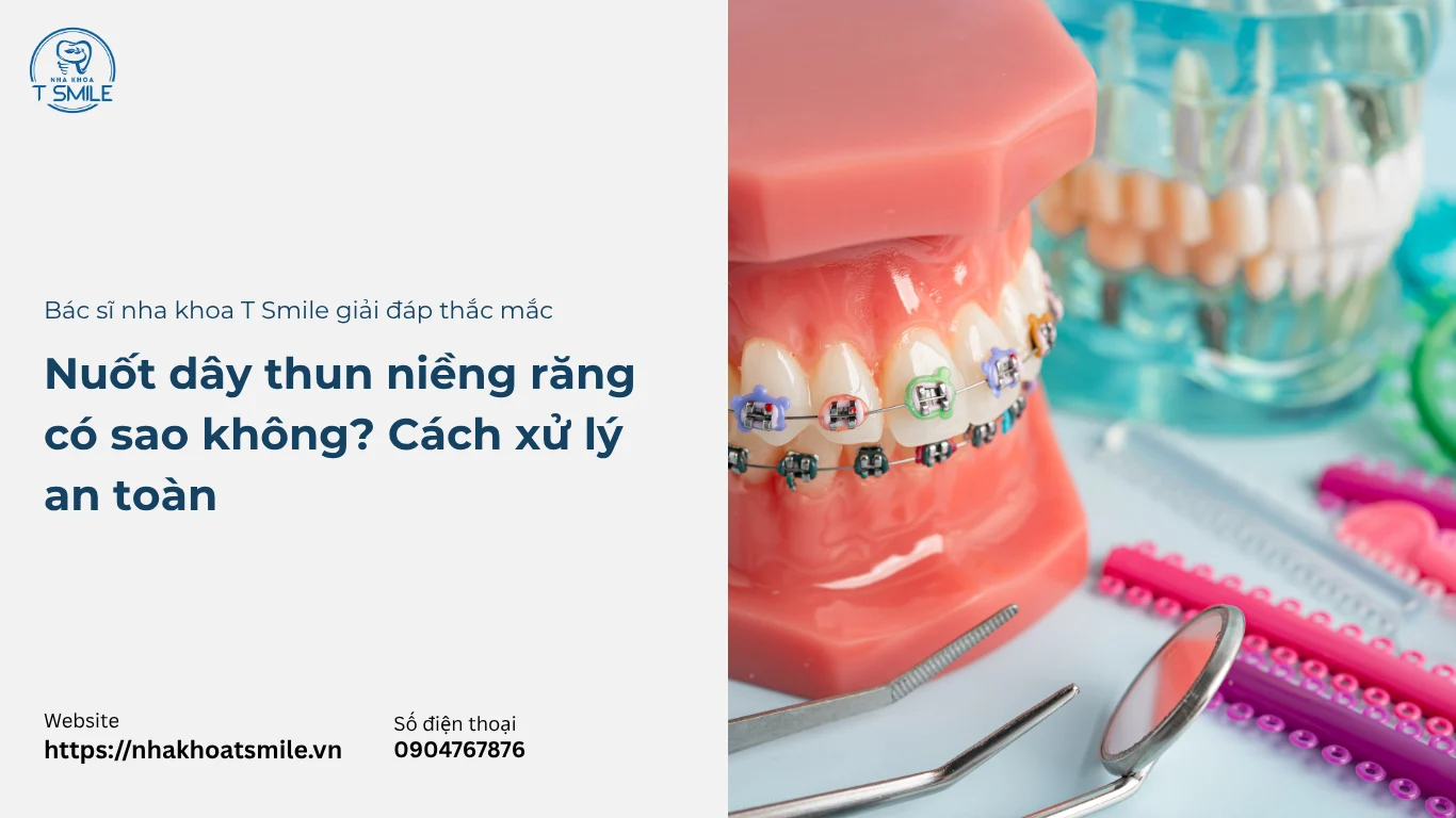 lỡ nuốt dây thun niềng răng có sao không