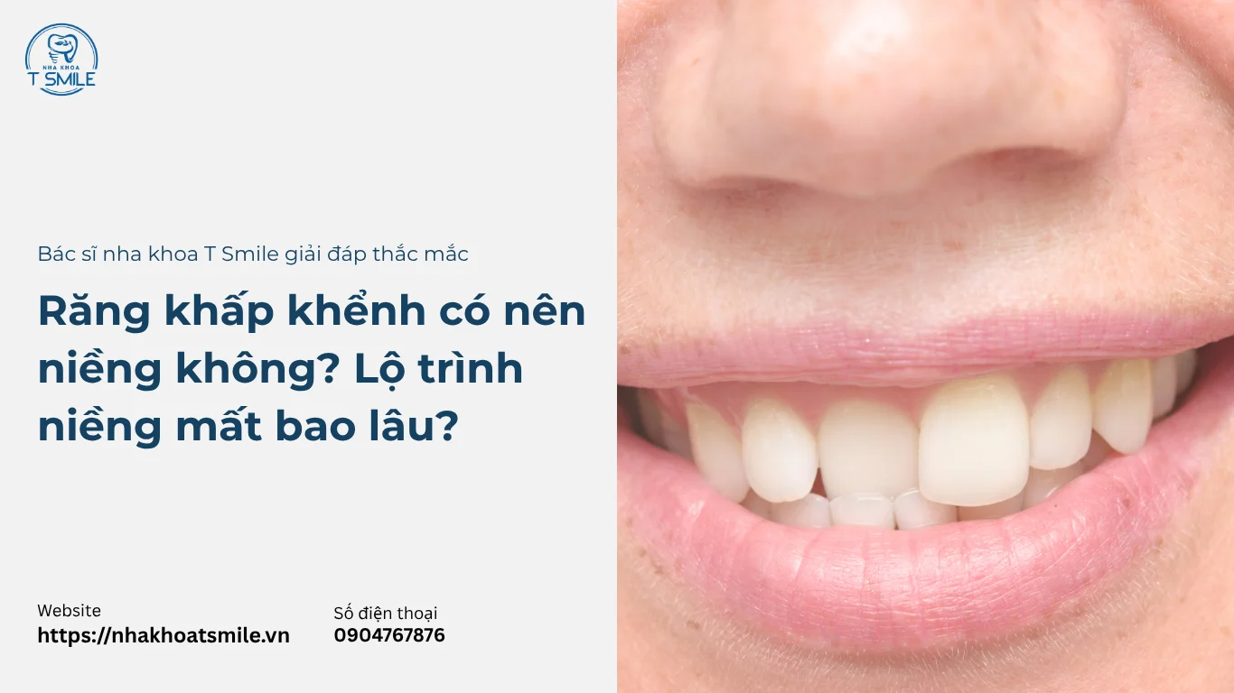 răng khấp khểnh có nên niềng không