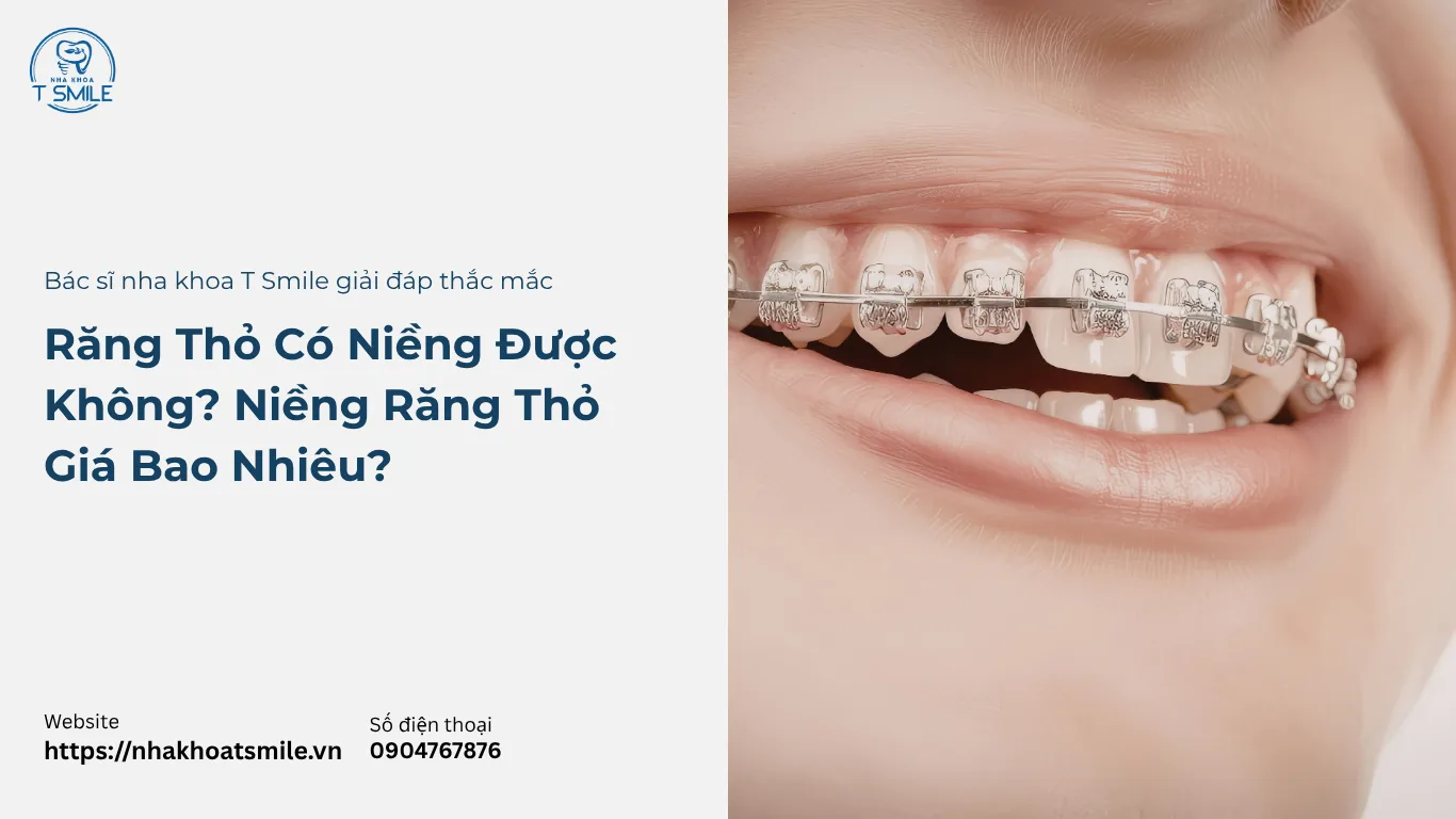 răng thỏ có niềng được không