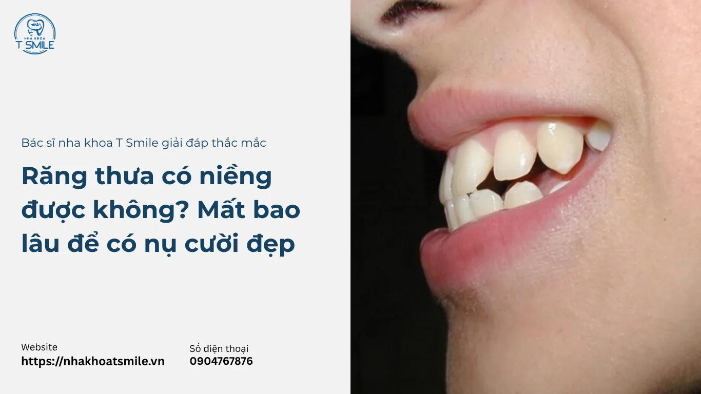 răng thưa có niềng được không