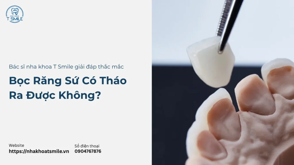 bọc răng sứ có tháo ra được không