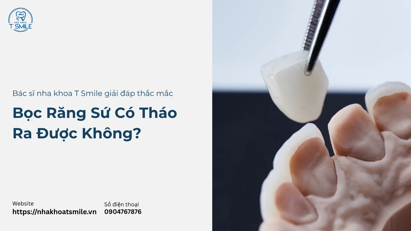 bọc răng sứ có tháo ra được không
