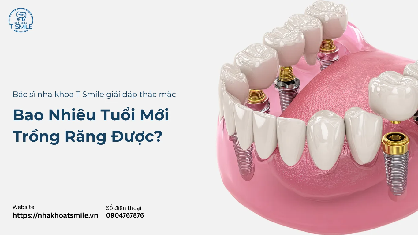 bao nhiêu tuổi mới trồng răng được
