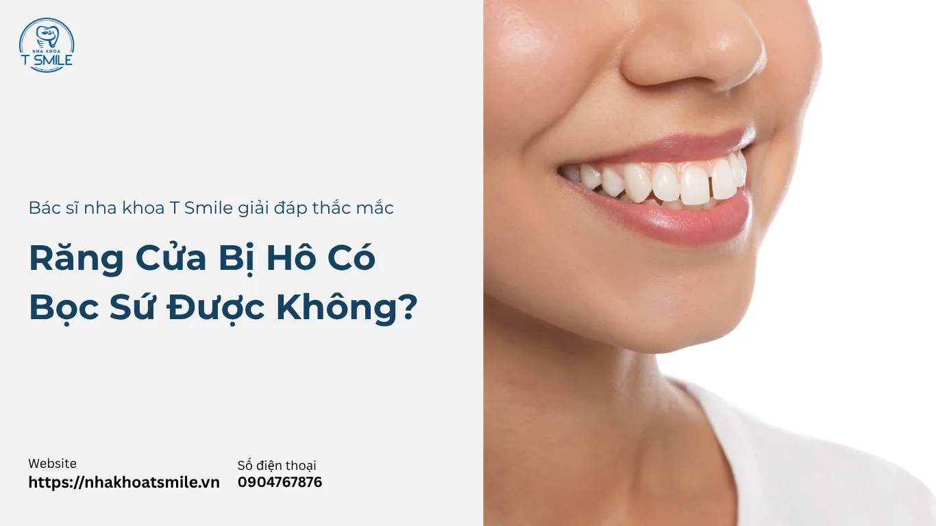 bọc răng sứ cho răng cửa bị hô
