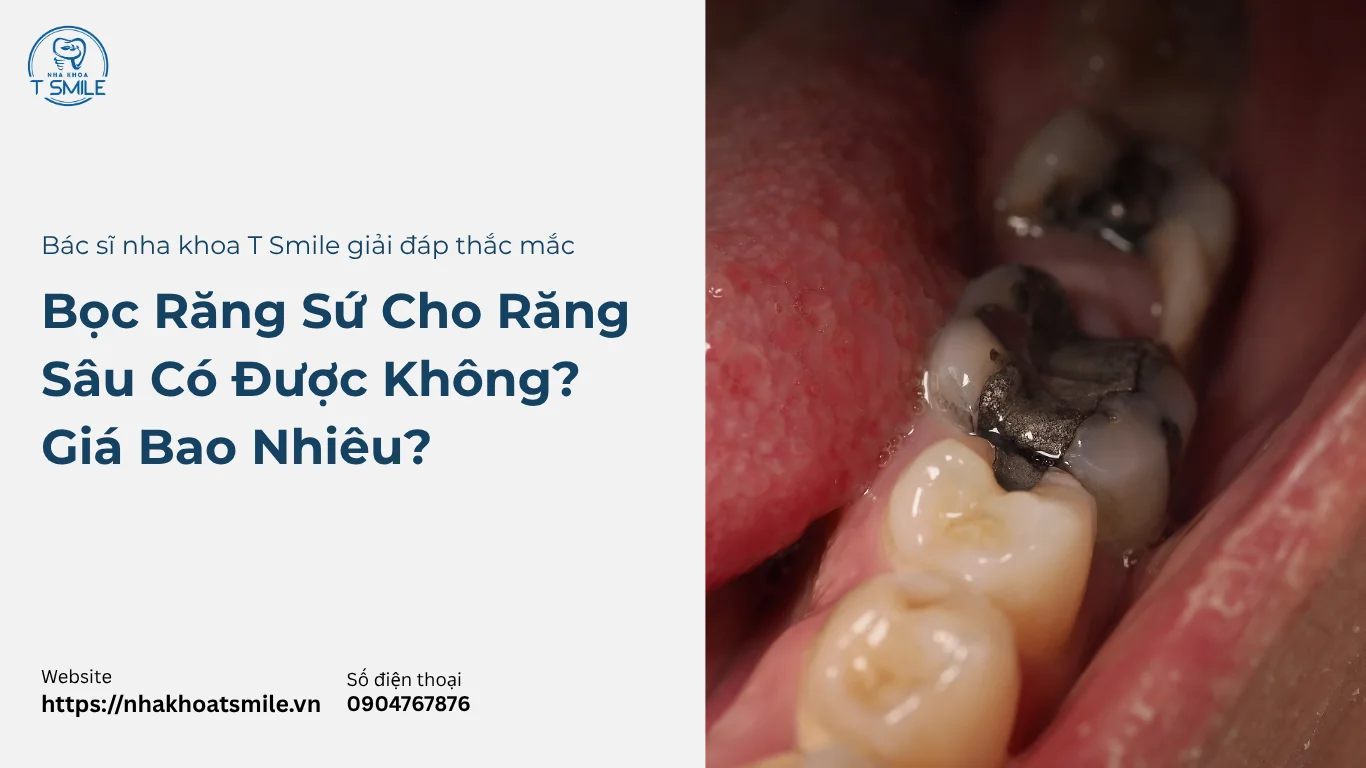bọc răng sứ cho răng sâu
