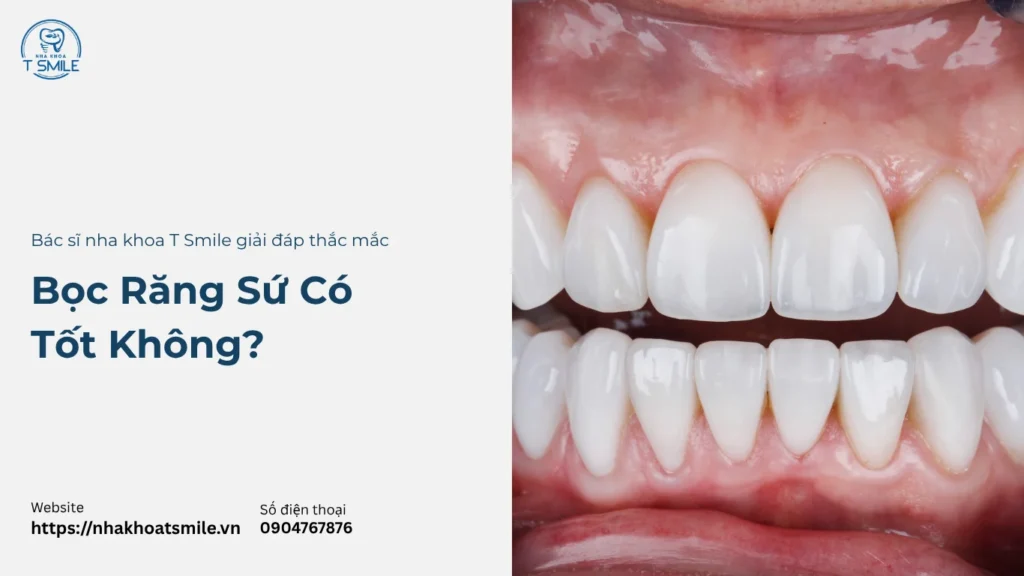 bọc răng sứ có tốt không