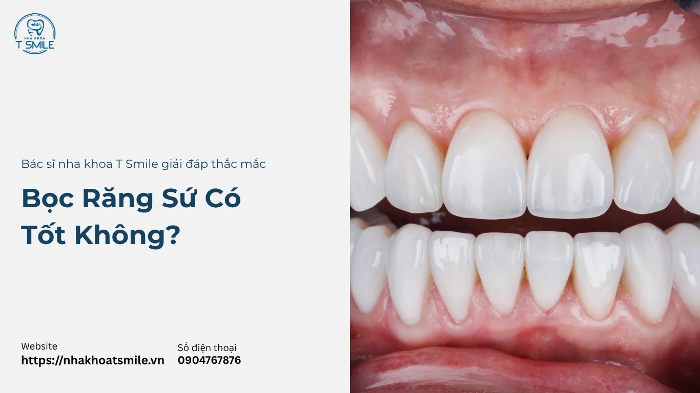 bọc răng sứ có tốt không
