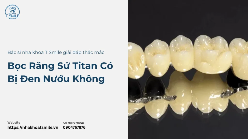 bọc răng sứ titan có bị đen không