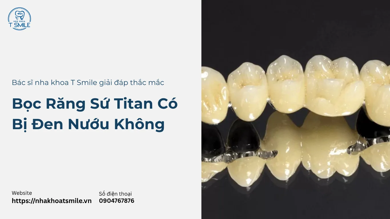 bọc răng sứ titan có bị đen không