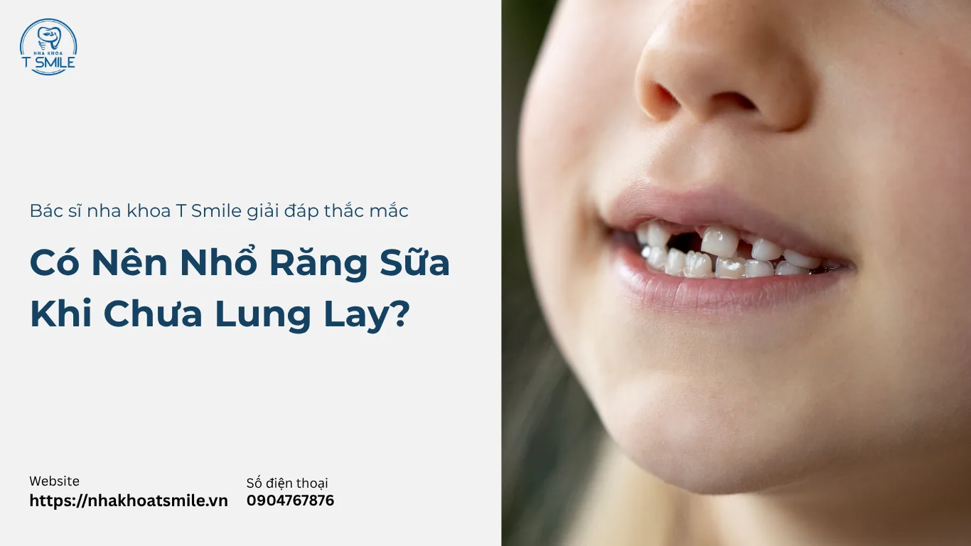 có nên nhổ răng sữa khi chưa lung lay​