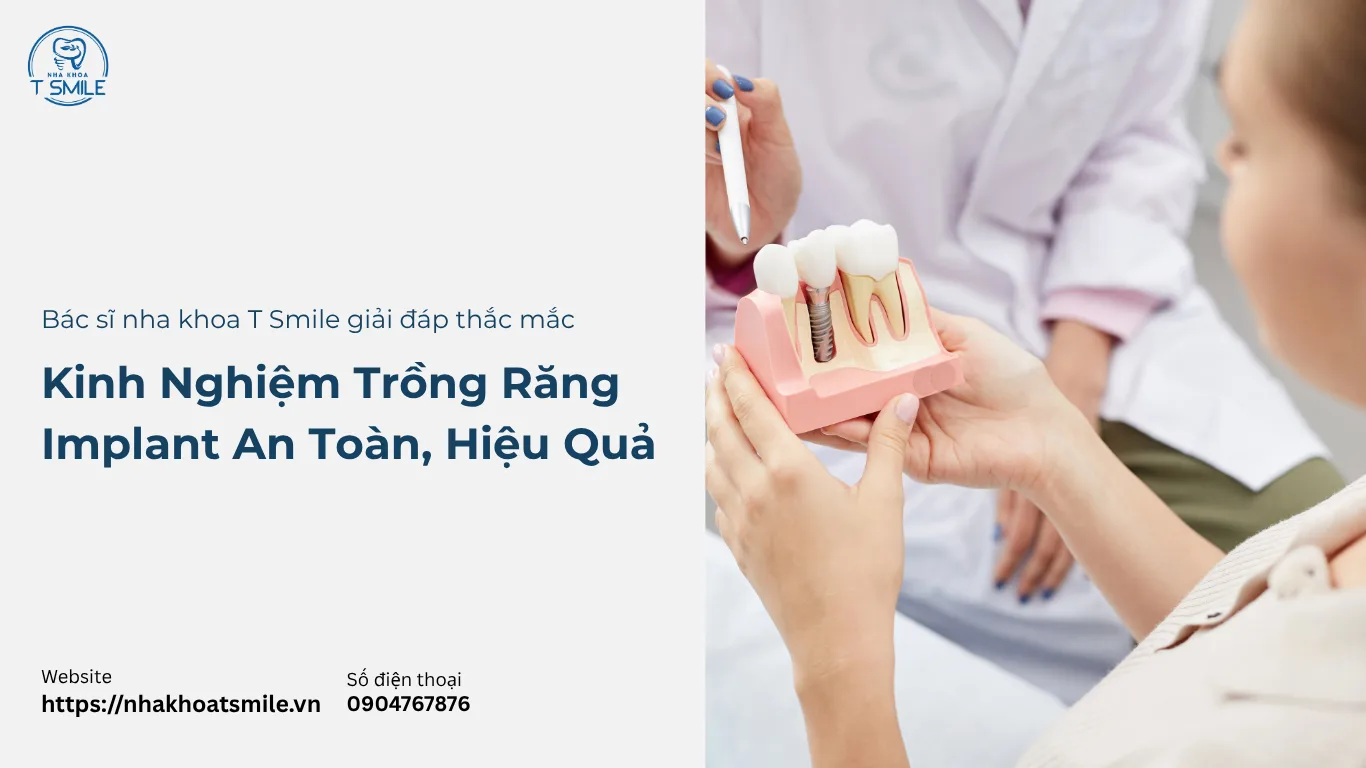 kinh nghiệm đi trồng răng Implant