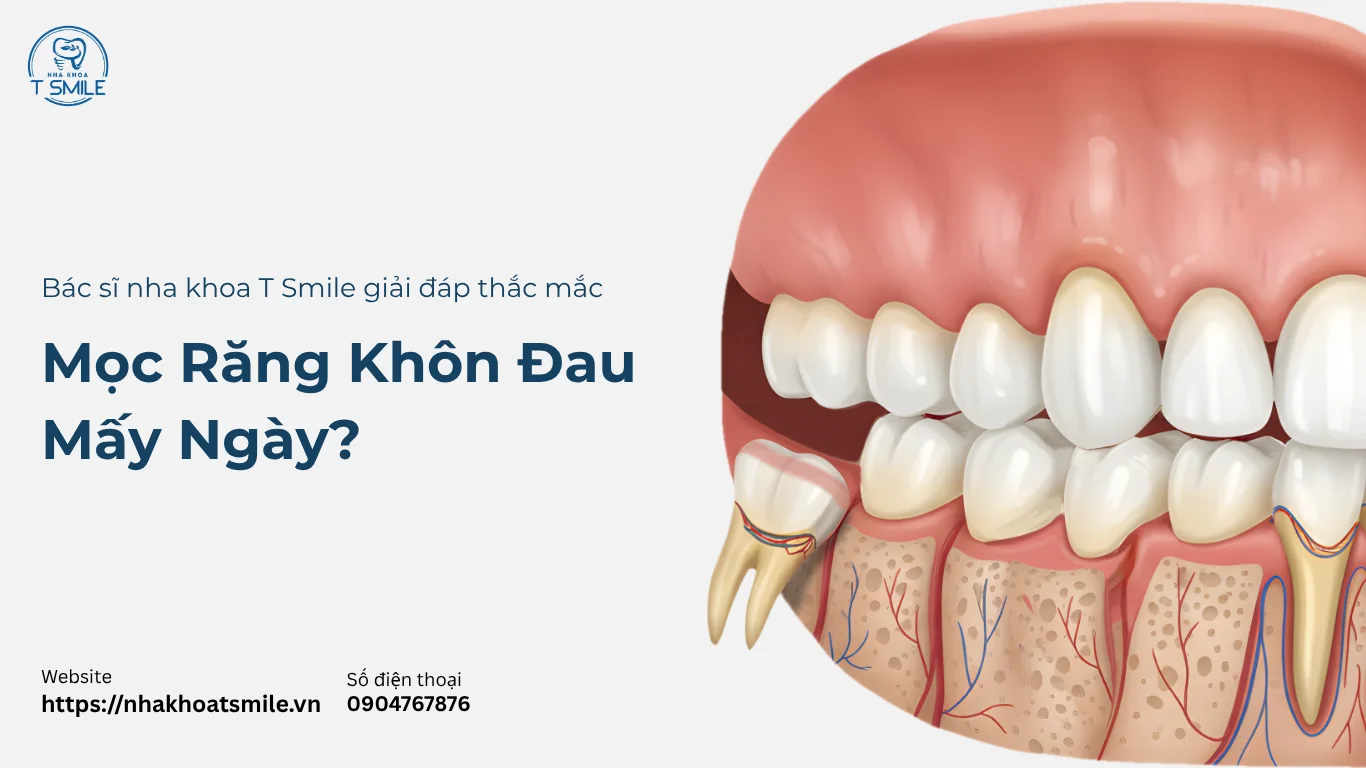 mọc răng khôn đau mấy ngày