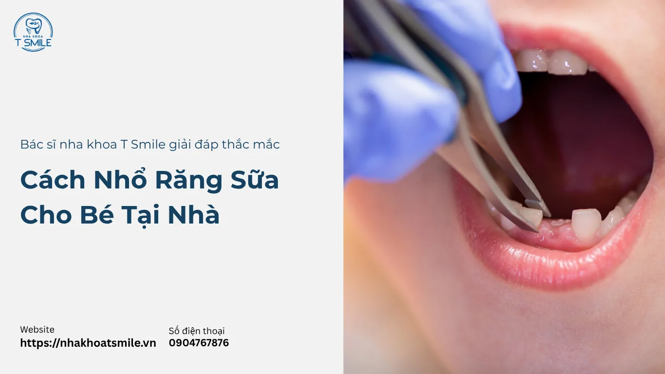 nhổ răng sữa cho bé