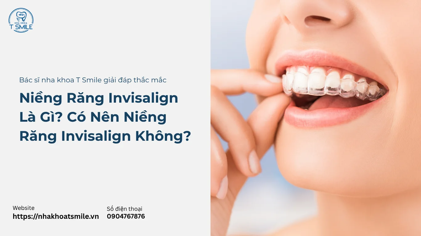 niềng răng Invisalign là gì