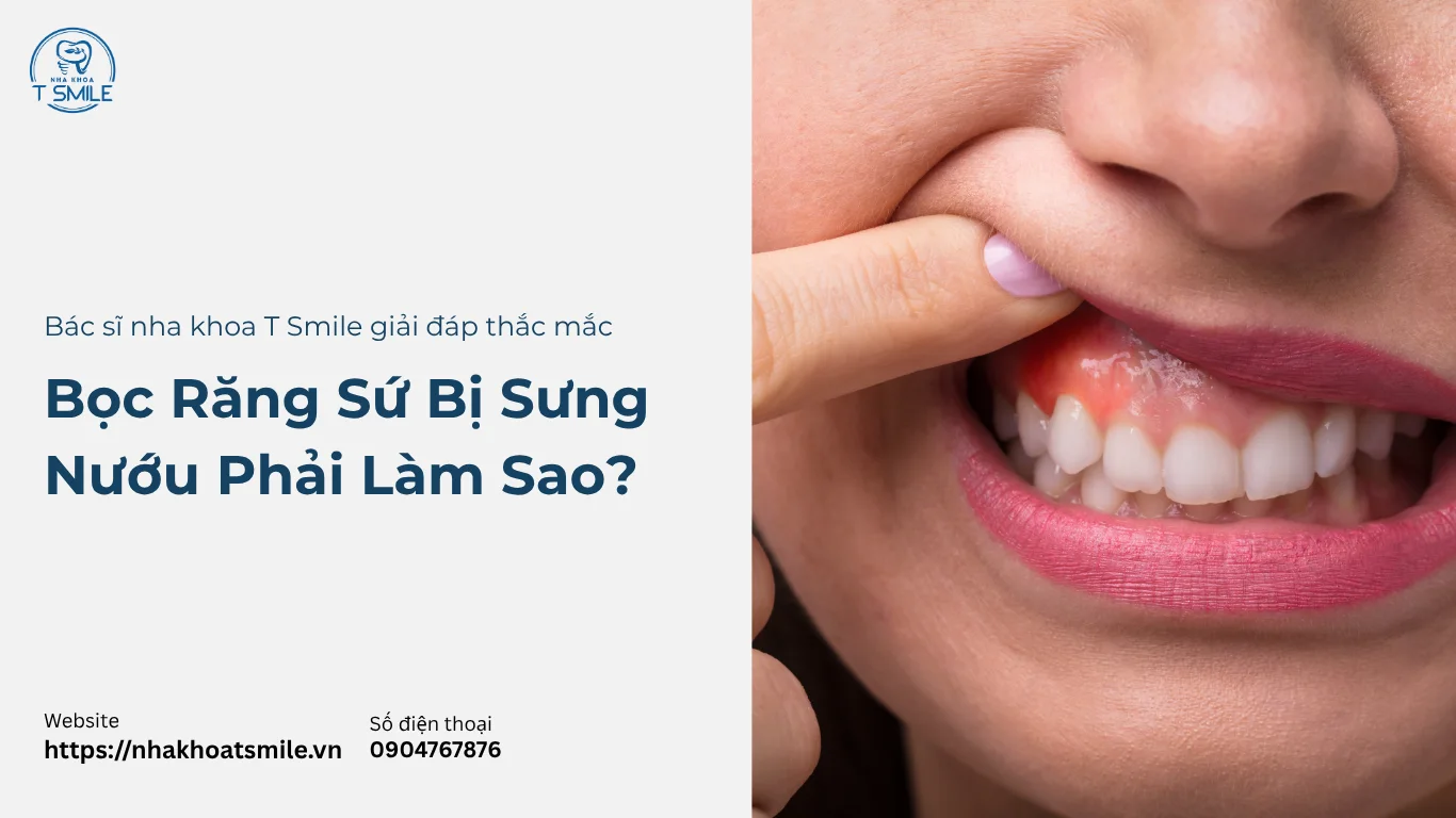 bọc răng sứ bị sưng nướu
