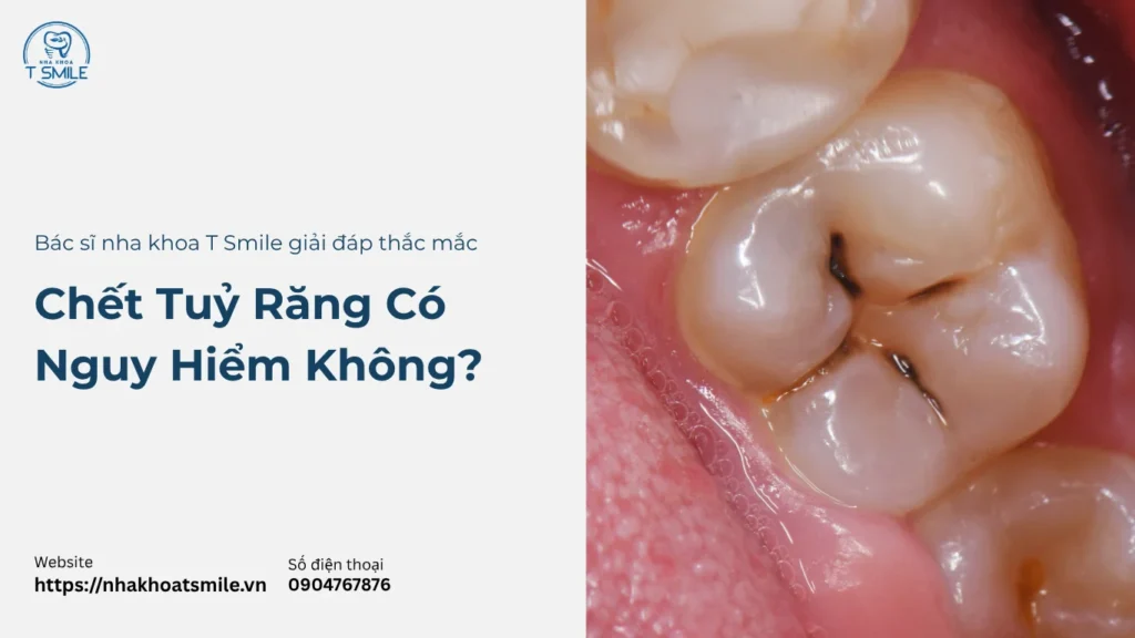 chết tuỷ răng có nguy hiểm không
