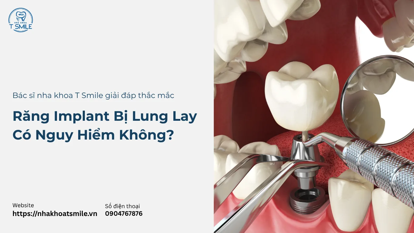 răng implant bị lung lay