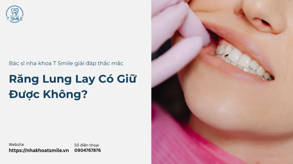 răng lung lay có giữ được không
