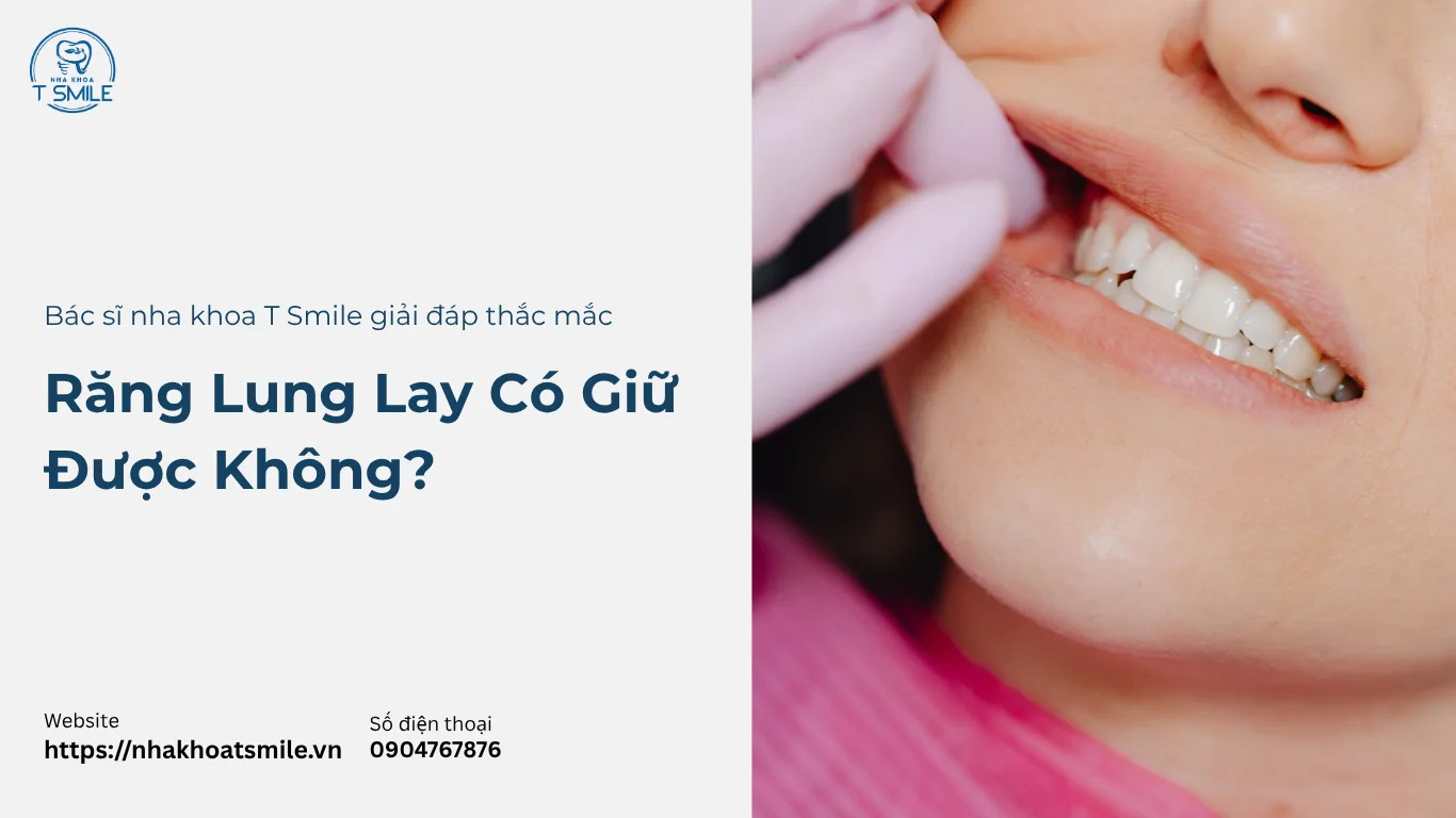 răng lung lay có giữ được không