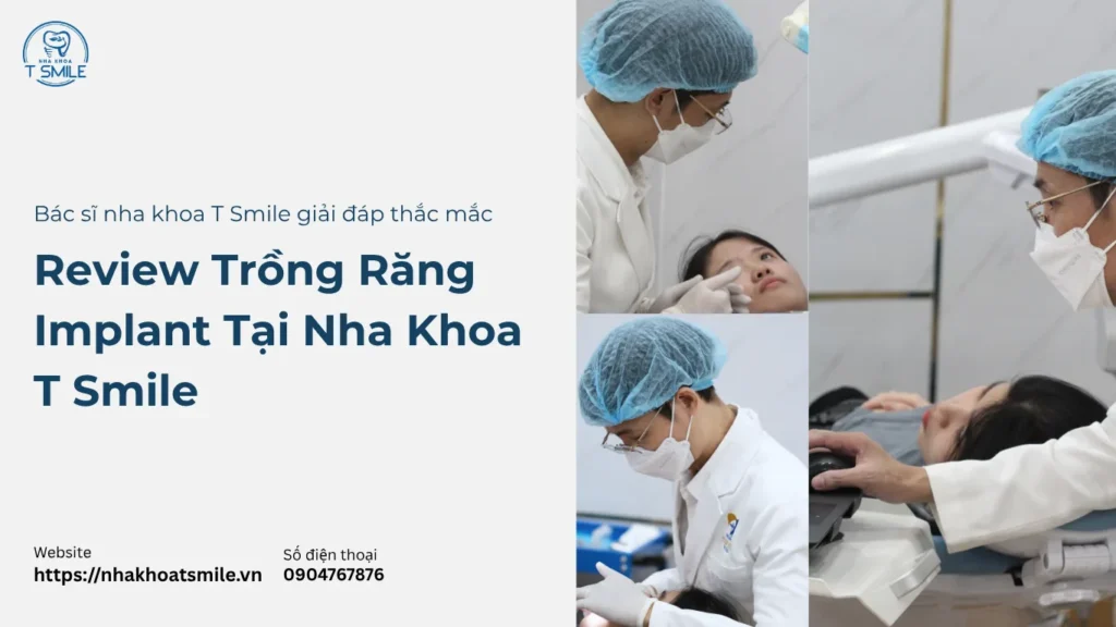 review trồng răng implant