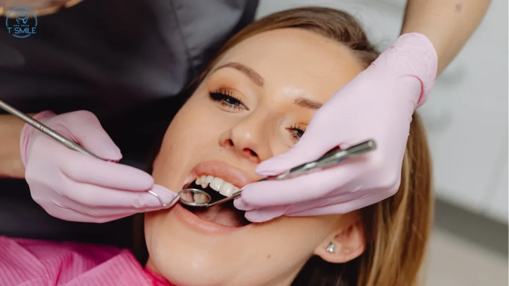 bọc răng sứ có tháo ra được không