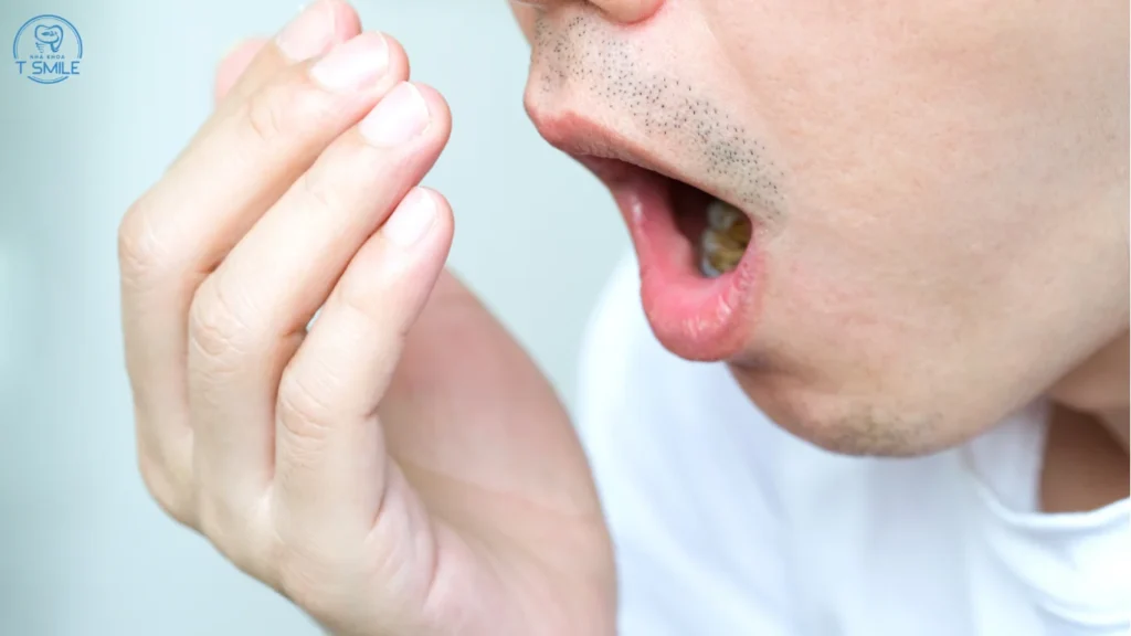 trám răng rồi có bị sâu lại không