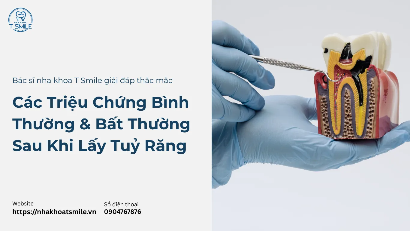 triệu chứng sau khi lấy tuỷ răng
