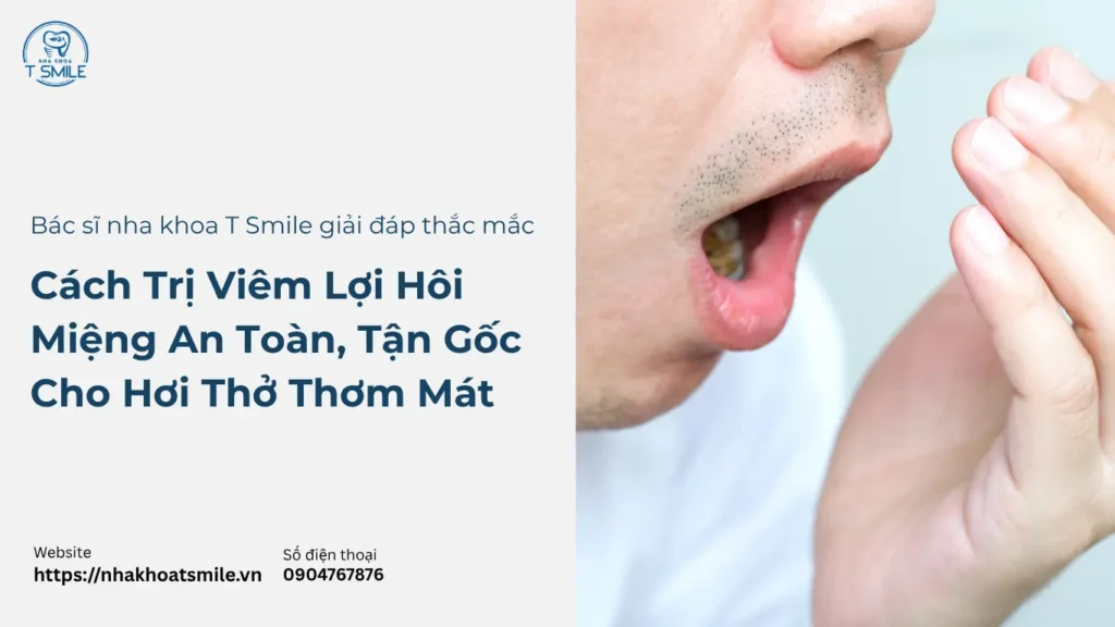 cách trị viêm lợi hôi miệng