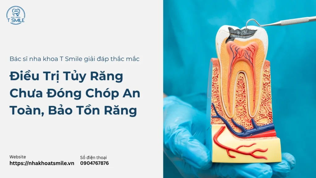 điều trị tủy răng chưa đóng chóp