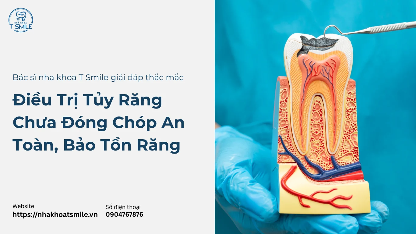 điều trị tủy răng chưa đóng chóp