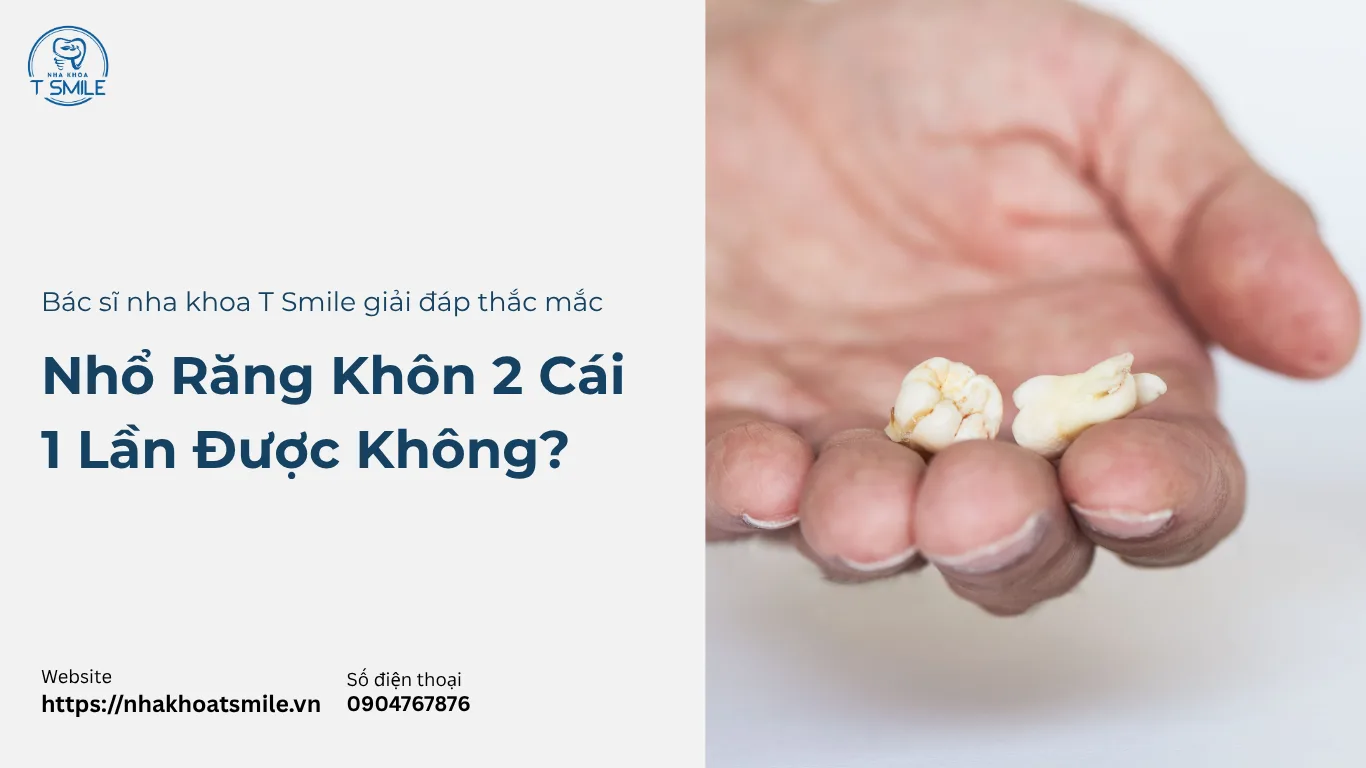 nhổ răng khôn 2 cái 1 lần được không